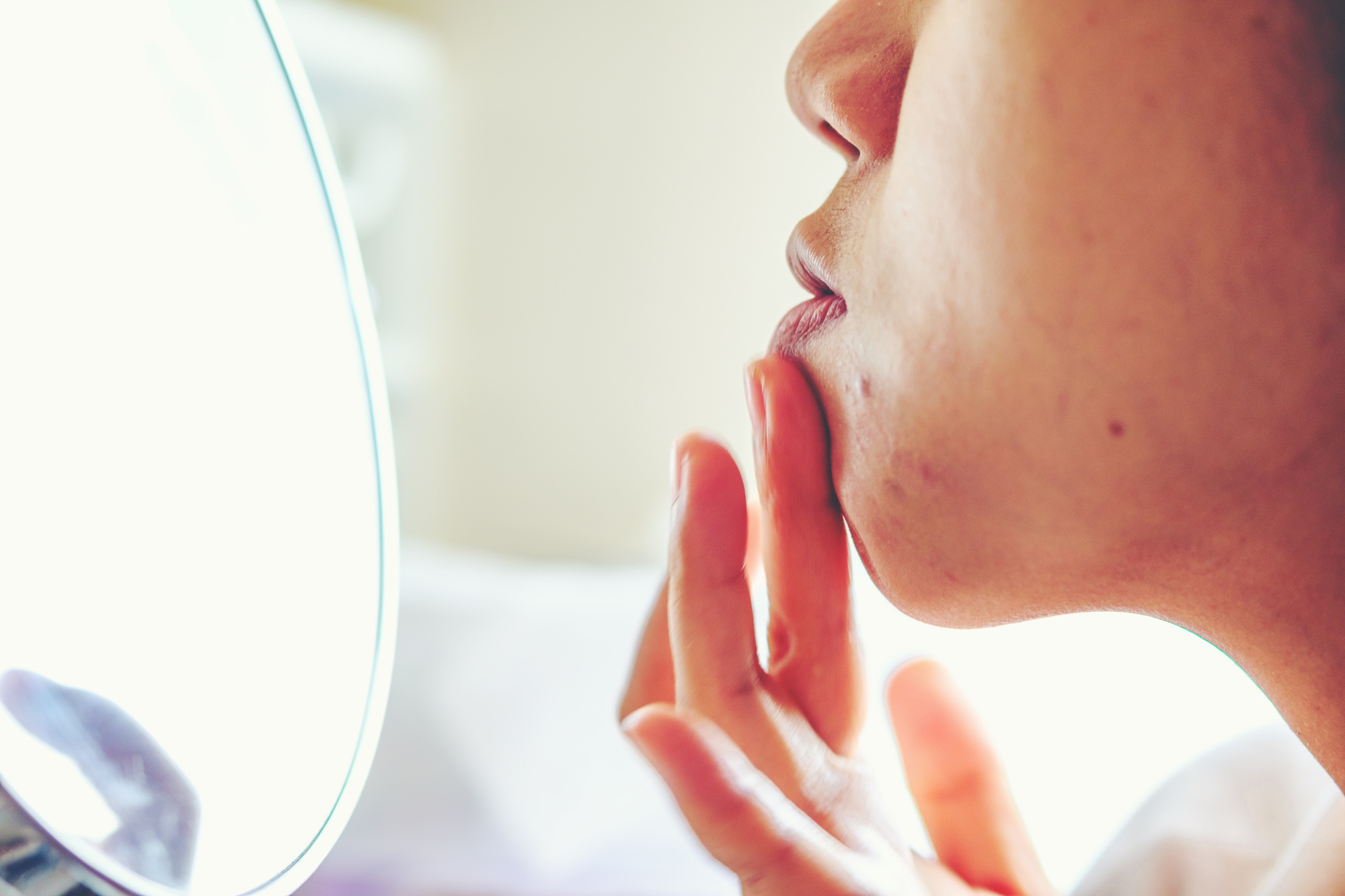 acne ayurveda
